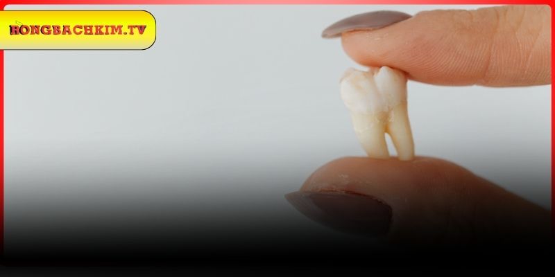 Tìm hiểu thông tin khi mơ thấy rụng răng