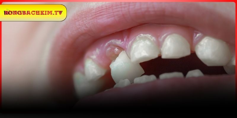 Trường hợp đánh con số chính xác nên lựa chọn